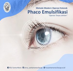 METODE MODERN OPERASI KATARAK PHACO EMULSIFIKASI